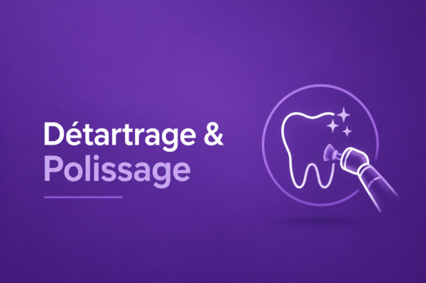 Détartrage & Polissage